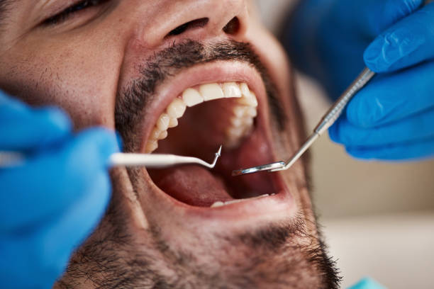 Best Emergency Dental Care for Sports Injuries in East Port Orchard, WA