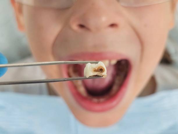 Best Emergency Treatment for Jaw Pain or Injury in East Port Orchard, WA